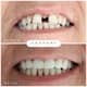 Slider image (9) Adaport Dental Clinic
